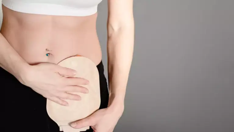 Noções Gerais de Ostomia e o Aconselhamento na Farmácia
